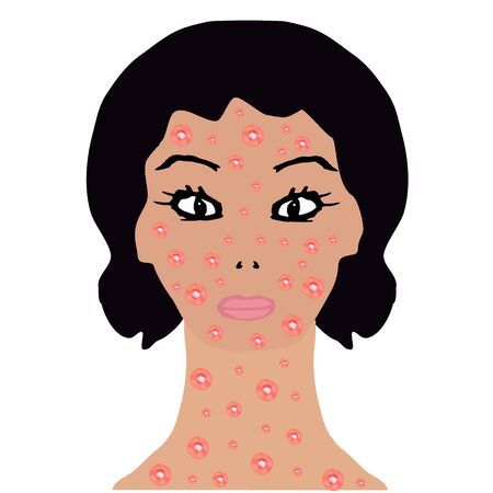 Popular Ingredients in UK Deep Conditioning Masks