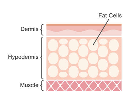 Busting Cellulite Myths
