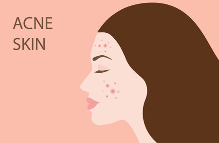 Choosing the Perfect Shade: Undertones & Overtones