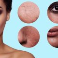 Understanding Sensitive Skin: Causes, Symptoms, and UK-Specific Triggers