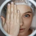 How to Conceal Blemishes and Acne: Tips from British Dermatologists